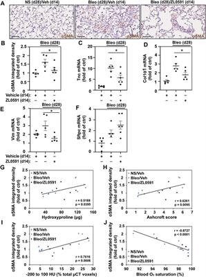 Selective Inhibition of Bromodomain-Containing Protein 4 Reduces Myofibroblast Transdifferentiation and Pulmonary Fibrosis